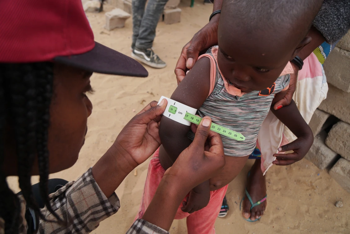 Esperança, one of our colleagues in Angola, is measuring the hand of a small girl.