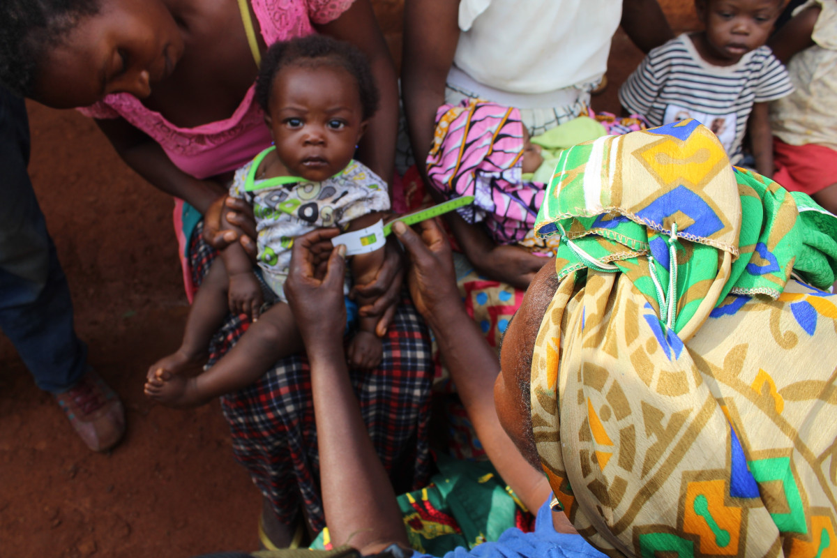 Treatment of acute malnutrition and support of health-care facilities in Bijombo region