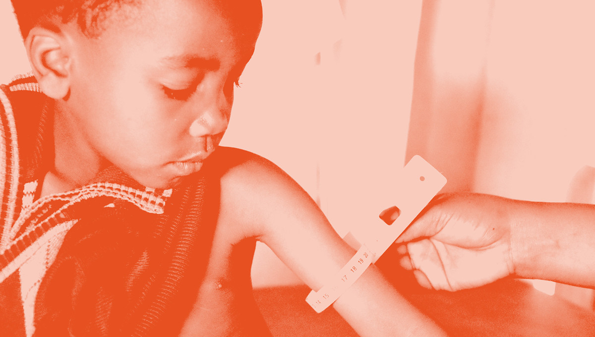 Integrated Programming for Improved Nutrition